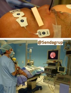 endoscopia-en-se