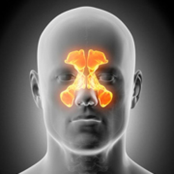 Cu ndo Es Conveniente Operar La Sinusitis O Rinosinusitis Agencia cu-ndo-es-conveniente-operar-la-sinusitis-o-rinosinusitis-agencia