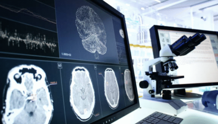 Resultados-esperanzadores-en-el-avance-de-la-investigacion-del-alzheimer-Lecanemab-06-20-2025_11_12_AM-1024x582-1